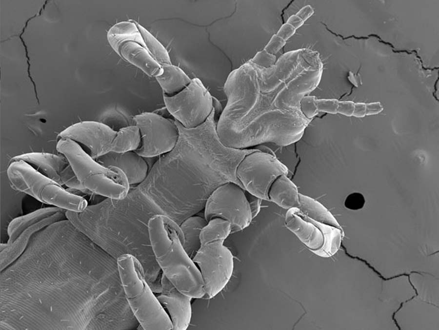 Fotografia de un piojo visto microscopio electr�nico